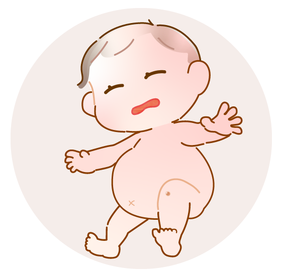 図3:JXGの症状(赤ちゃんの全身図のイラスト)